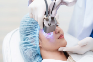Side view of asian woman getting resurfacing laser fraxel dual and ultrasound face treatment in medical spa center.